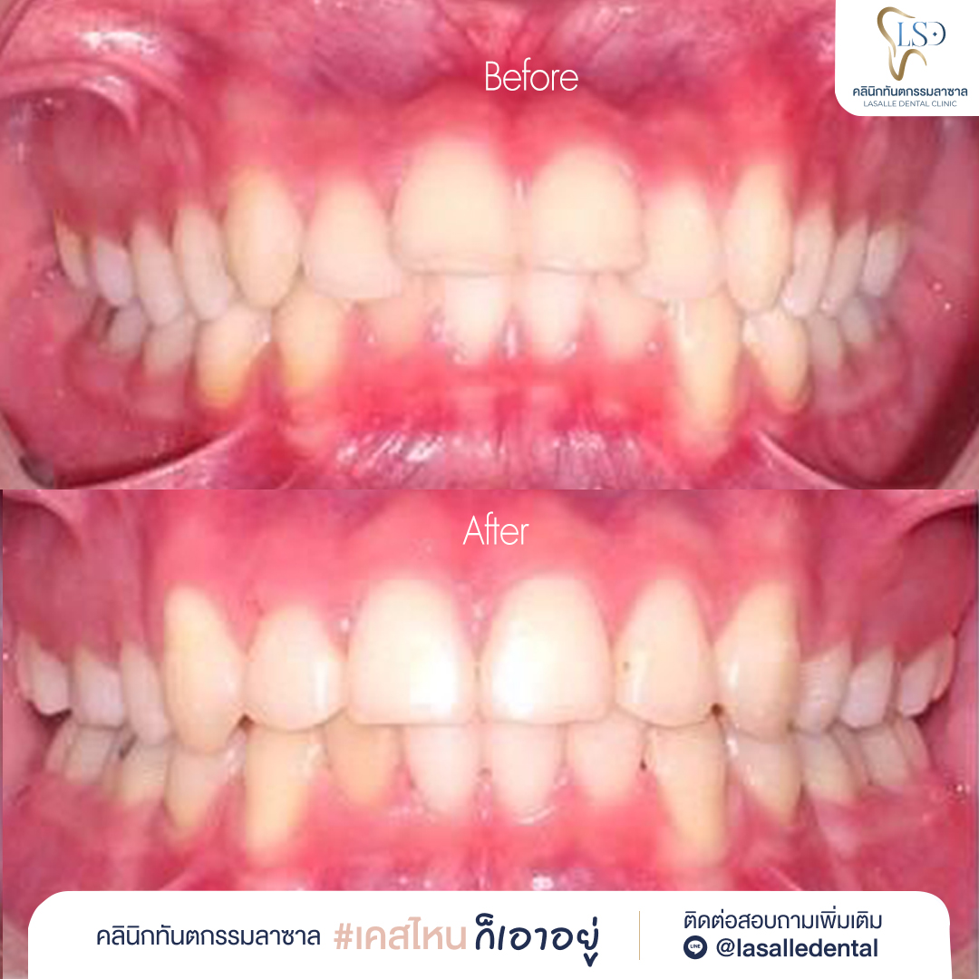 ✅Lasalle_AW01-02(1)