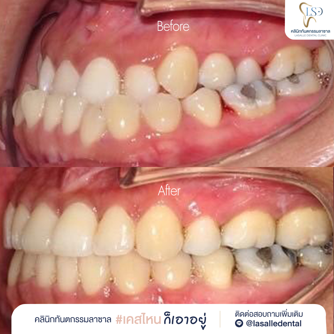 ✅Lasalle_AW01-04(1)